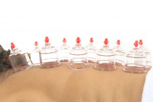 Person Receiving Cupping